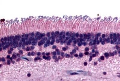 Immunohistochemistry-Paraffin: PTP mu/PTPRM Antibody [NBP3-14456]